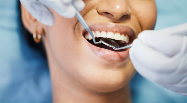 Best Emergency Tooth Extraction in Presidio, TX